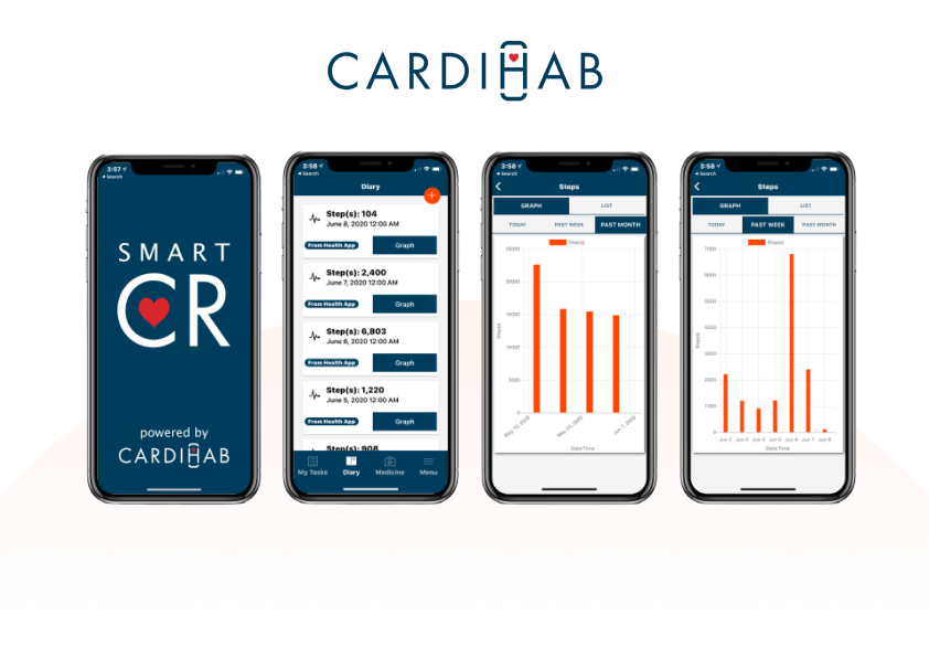 Cardihab SmartCR app screens showing activity summaries and data visualisation